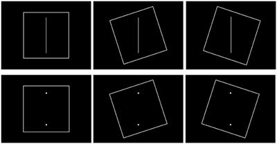 Effect of Postural Control Demands on Early Visual Evoked Potentials during a Subjective Visual Vertical Perception Task in Adolescents with Idiopathic Scoliosis